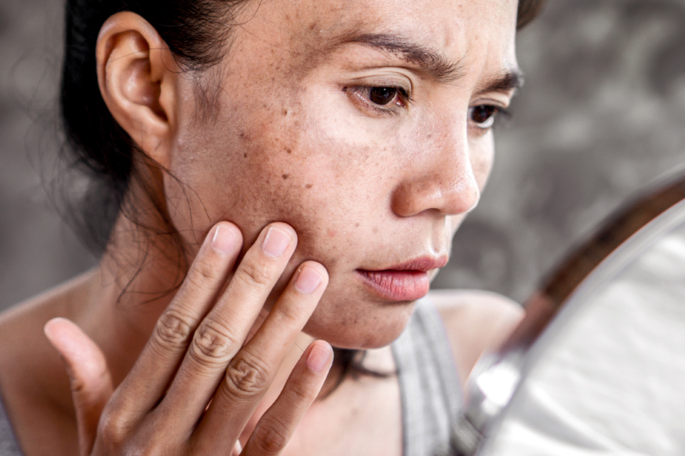 How to Repair Sun Damage with Antioxidants + Sunscreen