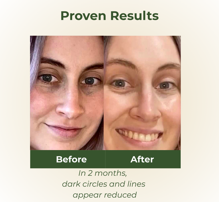 BOTANI RESCUE EYE TREATMENT 25ml