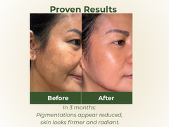 BOTANI ACAI BERRY ACTIVE ANTIOXIDANT SERUM 15ML